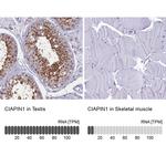 CIAPIN1 Antibody in Immunohistochemistry (IHC)