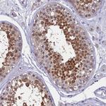 CIAPIN1 Antibody in Immunohistochemistry (IHC)