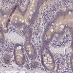 OAS3 Antibody in Immunohistochemistry (Paraffin) (IHC (P))