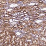 TRMT1 Antibody in Immunohistochemistry (Paraffin) (IHC (P))