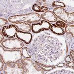 ATP Synthase O Antibody in Immunohistochemistry (Paraffin) (IHC (P))