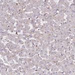 CHMP4B Antibody in Immunohistochemistry (IHC)