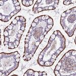 CHMP4B Antibody in Immunohistochemistry (IHC)