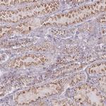 CHMP4B Antibody in Immunohistochemistry (IHC)