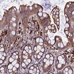 RLTPR Antibody in Immunohistochemistry (Paraffin) (IHC (P))