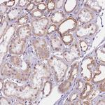 UACA Antibody in Immunohistochemistry (Paraffin) (IHC (P))