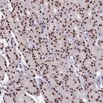 SNRPD2 Antibody in Immunohistochemistry (Paraffin) (IHC (P))