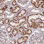 PAGR1 Antibody in Immunohistochemistry (Paraffin) (IHC (P))