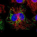 SBCAD Antibody in Immunocytochemistry (ICC/IF)