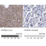 SBCAD Antibody in Immunohistochemistry (IHC)