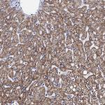 SBCAD Antibody in Immunohistochemistry (IHC)