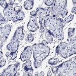 SBCAD Antibody in Immunohistochemistry (IHC)