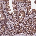 POLR3E Antibody in Immunohistochemistry (Paraffin) (IHC (P))