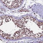 POLR3E Antibody in Immunohistochemistry (Paraffin) (IHC (P))