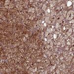 FAM96B Antibody in Immunohistochemistry (IHC)