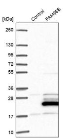 FAM96B Antibody in Western Blot (WB)