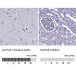 SLC1A6 Antibody in Immunohistochemistry (IHC)