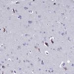 SLC1A6 Antibody in Immunohistochemistry (IHC)