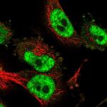 CD2BP2 Antibody in Immunocytochemistry (ICC/IF)