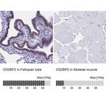 CD2BP2 Antibody in Immunohistochemistry (IHC)