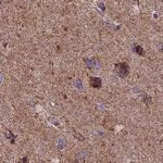 NDUFA8 Antibody in Immunohistochemistry (IHC)