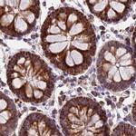 NDUFA8 Antibody in Immunohistochemistry (IHC)