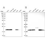 NDUFA8 Antibody in Western Blot (WB)