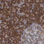 ALG2 Antibody in Immunohistochemistry (Paraffin) (IHC (P))