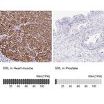 Sarcalumenin Antibody in Immunohistochemistry (IHC)