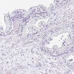 Sarcalumenin Antibody in Immunohistochemistry (IHC)