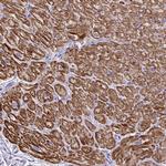 Sarcalumenin Antibody in Immunohistochemistry (IHC)