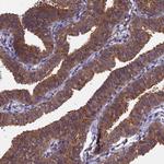 LCMT1 Antibody in Immunohistochemistry (Paraffin) (IHC (P))