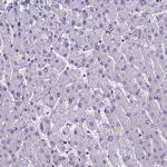 LCMT1 Antibody in Immunohistochemistry (Paraffin) (IHC (P))