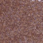 LCMT1 Antibody in Immunohistochemistry (Paraffin) (IHC (P))