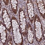 NSMCE1 Antibody in Immunohistochemistry (Paraffin) (IHC (P))