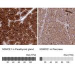 NSMCE1 Antibody in Immunohistochemistry (IHC)