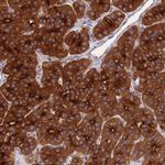 NSMCE1 Antibody in Immunohistochemistry (IHC)