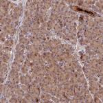 NSMCE1 Antibody in Immunohistochemistry (IHC)