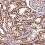 SQRDL Antibody in Immunohistochemistry (IHC)