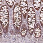 SQRDL Antibody in Immunohistochemistry (IHC)