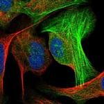 ALG2 Antibody in Immunocytochemistry (ICC/IF)