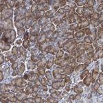 ALG2 Antibody in Immunohistochemistry (Paraffin) (IHC (P))