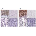 FDX1 Antibody in Immunohistochemistry (IHC)