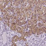 FDX1 Antibody in Immunohistochemistry (IHC)