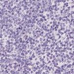 FDX1 Antibody in Immunohistochemistry (IHC)