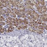 FDX1 Antibody in Immunohistochemistry (IHC)