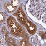 NUBP1 Antibody in Immunohistochemistry (IHC)