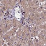 NUBP1 Antibody in Immunohistochemistry (IHC)