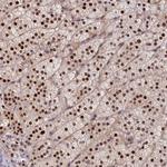 CHST12 Antibody in Immunohistochemistry (Paraffin) (IHC (P))