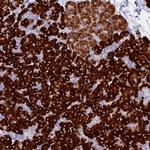 FKBP11 Antibody in Immunohistochemistry (Paraffin) (IHC (P))